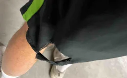 Kağıthane’de Başıboş Köpek Triatlon Sporcusunu Isırdı